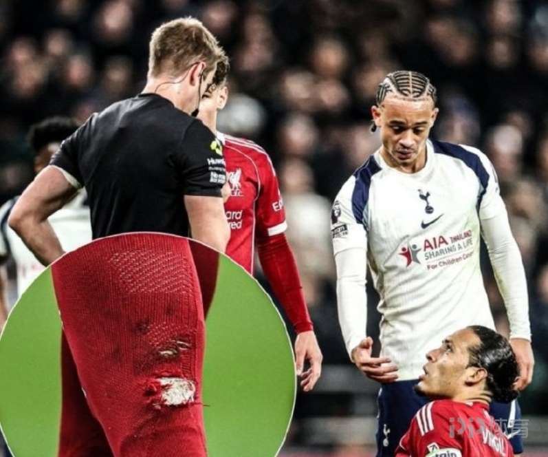  范戴克谈西蒙斯红牌：我认为他不是故意伤害我 赛后跟他聊过了