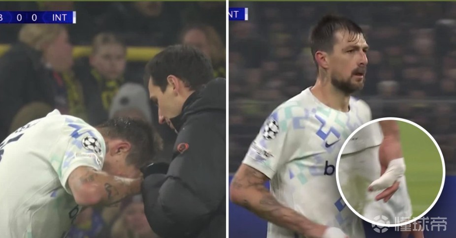 硬汉，阿切尔比手指脱臼场边直接接受队医复位