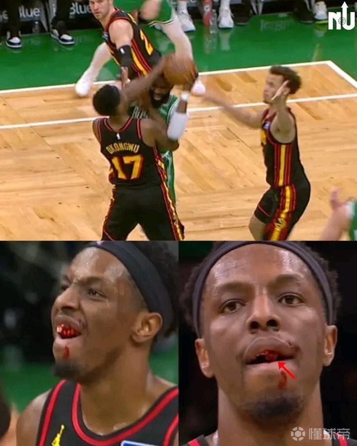  一肘打掉奥孔古牙齿，杰伦-布朗：我绝对不是故意的