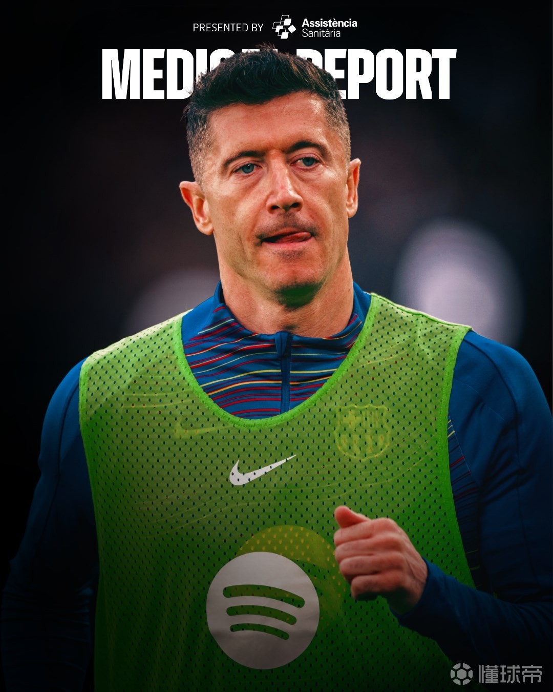 巴萨官方：莱万眼眶骨折，缺席对阵马竞的国王杯比赛